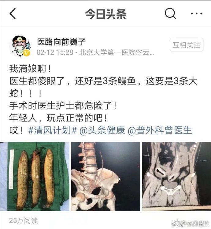 莫以鳝小而为之！年轻人，玩点正常的吧